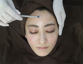 マッサージピール