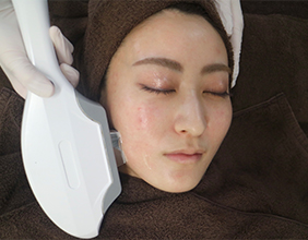 フォトフェイシャル