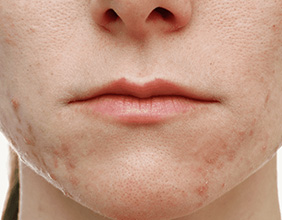 エンビロントリートメント